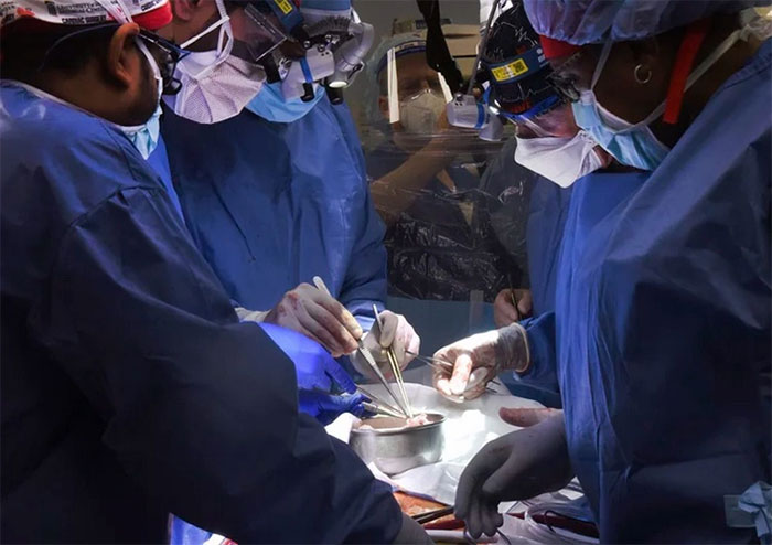 Picture 3 of America transplanted pig kidneys to living humans for the first time
