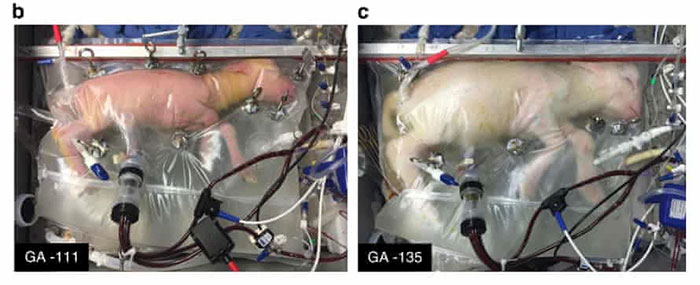 Picture 2 of Artificial uterus: In the future, women do not have to 'carry a painful birth' because there are machines to do it