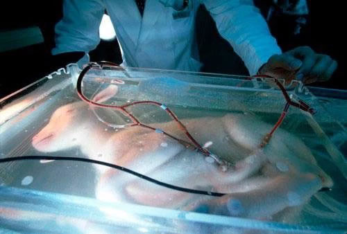 Picture 4 of Artificial uterus: In the future, women do not have to 'carry a painful birth' because there are machines to do it