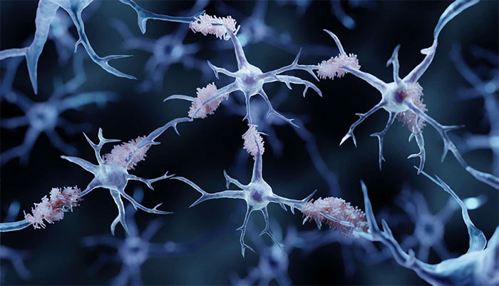 Blood transfusion opens new hope in the treatment of Alzheimer's disease Picture 1