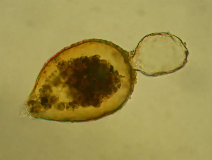 Close-up of magnetic bacteria residing in the deepest part of the ocean Picture 1