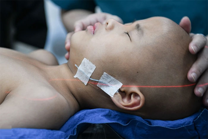 Picture 3 of Close-up of the process of 'making' cancer radiation therapy masks