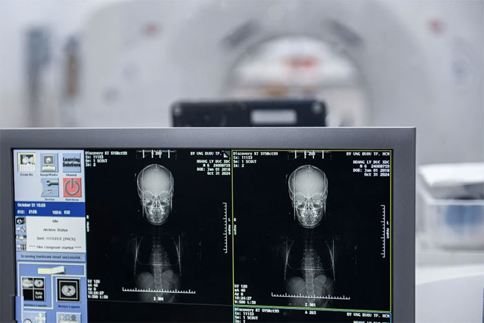 Picture 6 of Close-up of the process of 'making' cancer radiation therapy masks