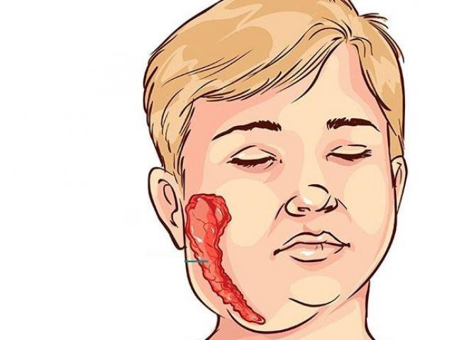 Picture 4 of Dangerous diseases that require vaccination from a young age