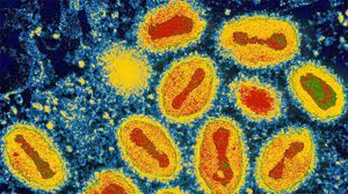 Picture 1 of Deadly epidemic viruses once 'disappeared without a trace'