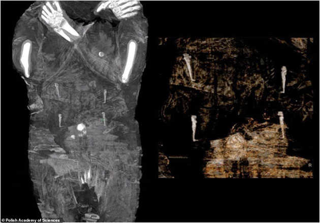 Decipher the mystery of how to preserve the fetus in a 2,000-year-old Egyptian mummy Picture 3