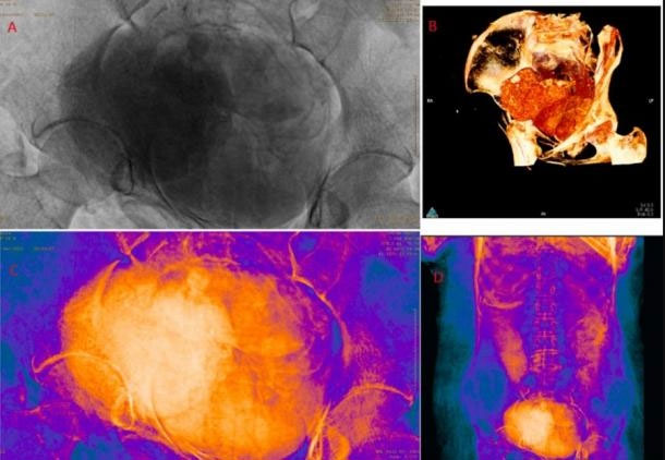 Decipher the mystery of how to preserve the fetus in a 2,000-year-old Egyptian mummy Picture 4