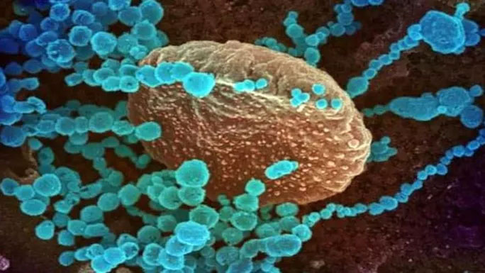 Picture 2 of Detecting new corona virus infecting humans