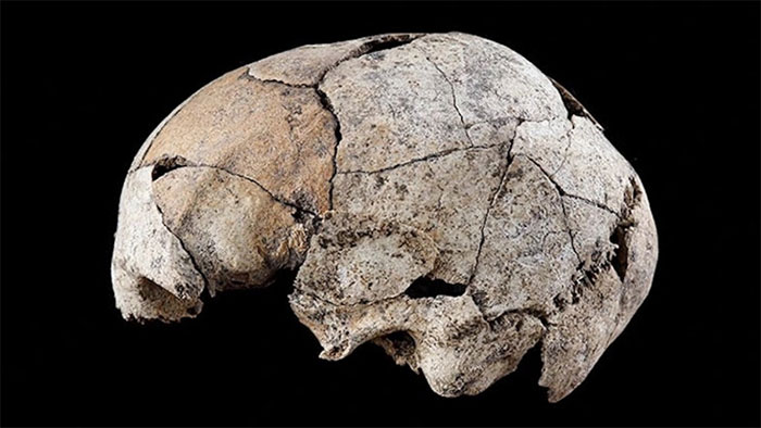 Picture 1 of Discovered the first ear surgery from the ancient skull 5,300 years ago