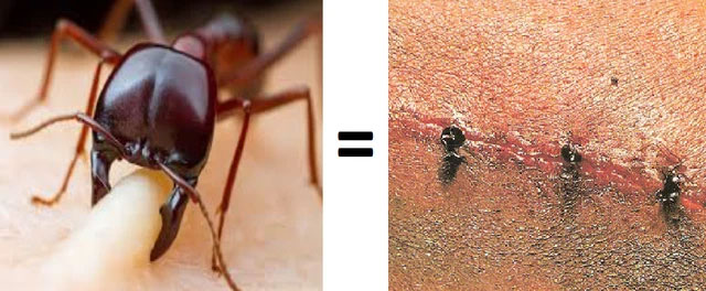 Don't play with fire ants, especially in Africa, they can 'turn' your body into Sashimi! Picture 5