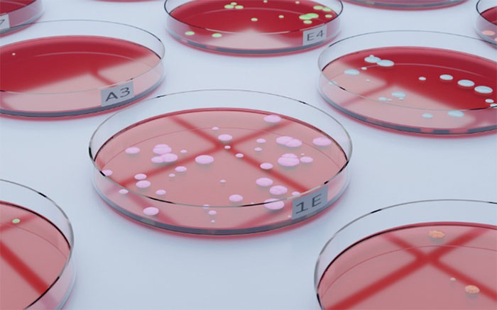 Picture 1 of Drug-resistant bacteria expected to kill tens of millions of people by 2050