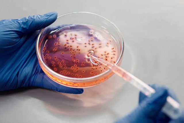 Picture 5 of Drug-resistant bacteria expected to kill tens of millions of people by 2050