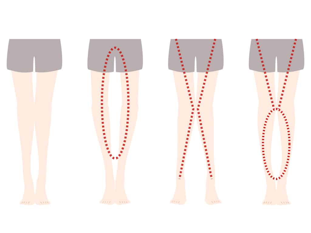 Picture 4 of Eat a lot of vegetables still big legs? Experts show you how to lose lower body fat
