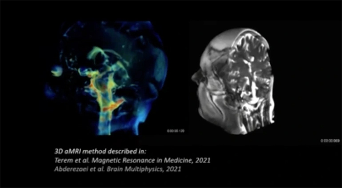 Finding the 'gateway' to deliver drugs to the brain Picture 1