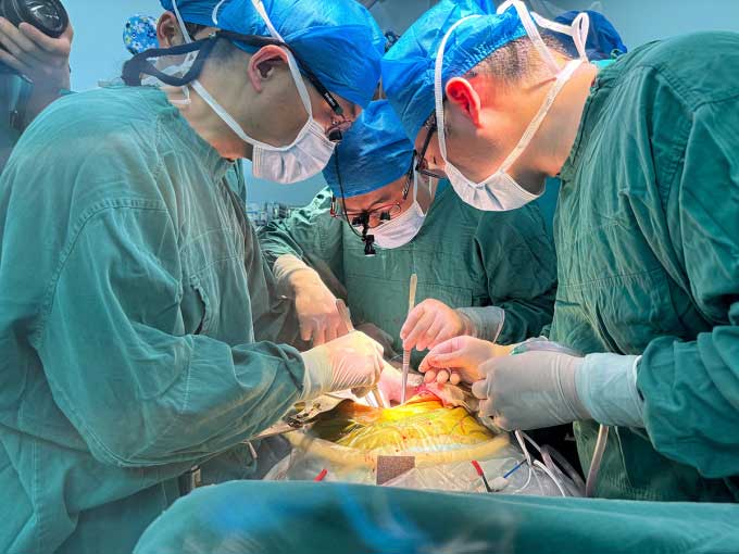 Picture 1 of First successful pig liver transplant to a living person