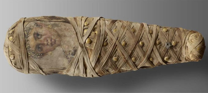Picture 1 of For the first time, a bandage wound was discovered in an Egyptian mummy