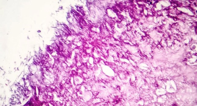 Picture 1 of Found a way to kill 99% of cancer cells