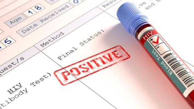 Picture 1 of Gene-editing drug development can cure HIV/AIDS?