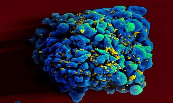 Picture 1 of HIV-preventing mRNA vaccine gives good results in animals
