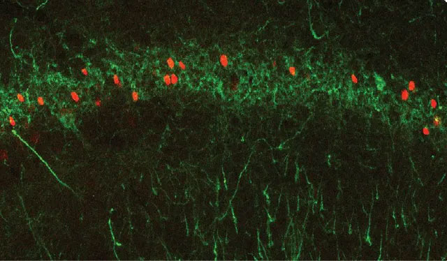 Picture 4 of How are memories formed?