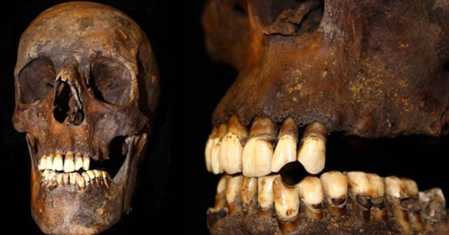 Picture 2 of How does smoking change the structure of human bones?