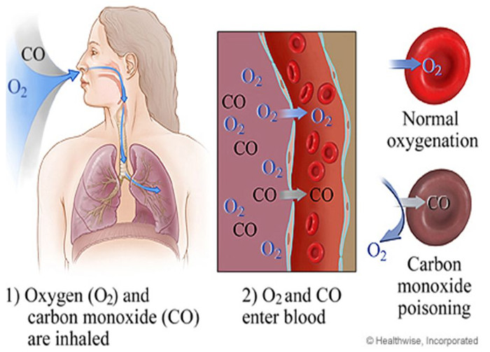 Picture 2 of How to prevent carbon monoxide poisoning when heating.