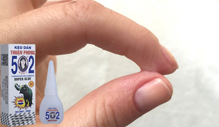 Picture 1 of How to remove 502 glue from your hands very simply