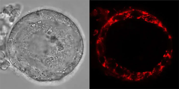 Picture 1 of Human egg cells can live up to 50 years