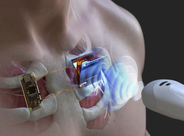 Picture 1 of Korean research team successfully uses ultrasonic waves to charge electronic devices remotely