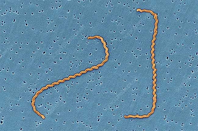 Leptospira Infection: Causes, Symptoms and Treatment Picture 1