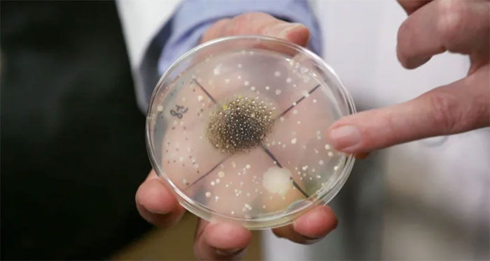 Microorganisms, mold 'attack' Space Station: Will they harm astronauts? Picture 3