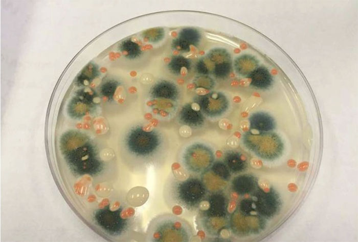 Microorganisms, mold 'attack' Space Station: Will they harm astronauts? Picture 4