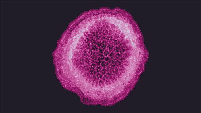 Mysterious virus causing hepatitis spreads to 11 countries, the first case dies Picture 1