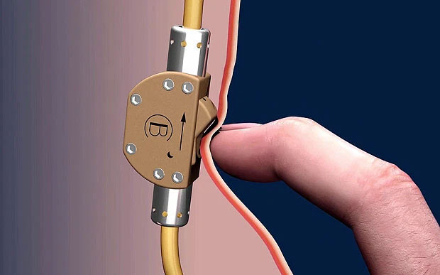 Picture 4 of Nanoparticles that heat testicles can help men avoid pregnancy for 7 days