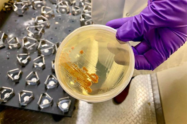Picture 2 of New breakthrough: Treating brain cancer with marine actinomycetes