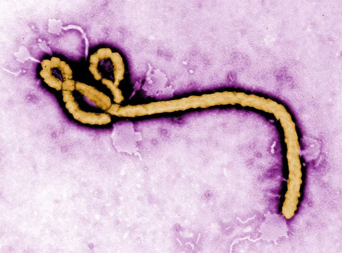 Picture 1 of New discovery about the virus that causes 25-90% of infected people to die