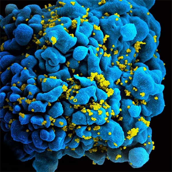 Picture 2 of New method can cure AIDS with just one injection
