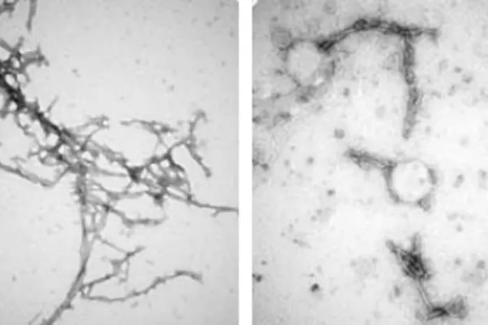 New method 'prevents' Parkinson's with nanotechnology Picture 1