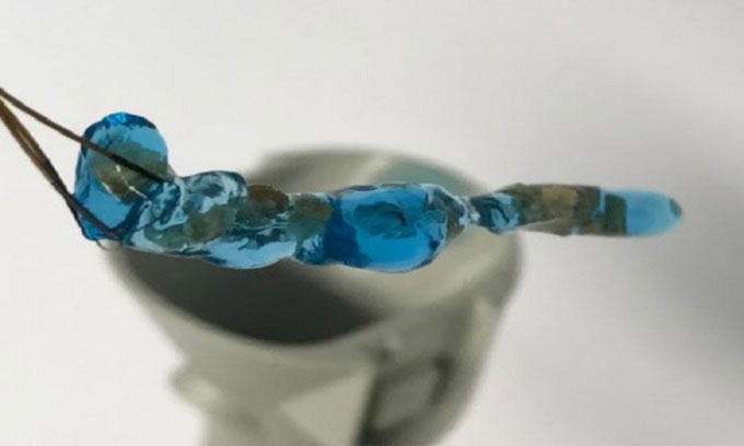 Picture 1 of New type of Hydrogel helps to clean out kidney stones in the body