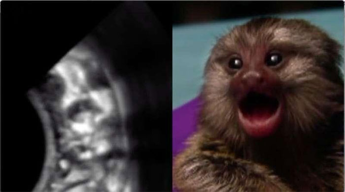 Picture 1 of Newly published research shows that: marmosets know how to call their mother from the moment they are in the womb