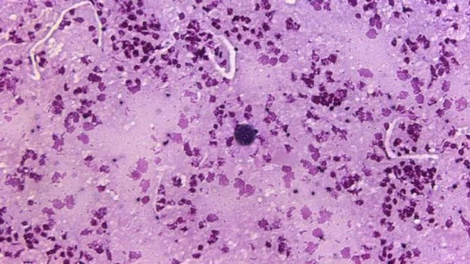 Parasites 'brainwash' young hyenas, urging them to come close to predators Picture 2