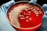 Pharmaceuticals pollute rivers, experts warn of next pandemic Picture 3