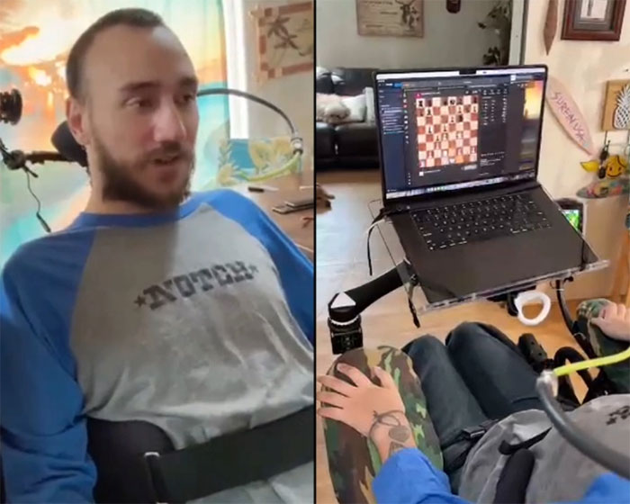 Picture 1 of Quadriplegic patient had brain chip implanted by Neuralink to play online chess
