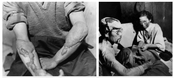 Picture 8 of Rare photos of Hiroshima and Nagasaki after the atomic bomb tragedy, 78 years later, still haunting