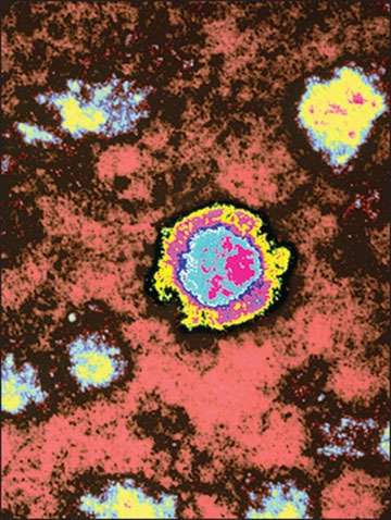 Rare virus that causes nearly 100% death suddenly 're-emerges' Picture 1