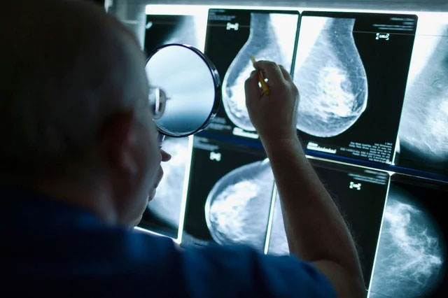 Picture 1 of Researchers have found a chance to block breast cancer