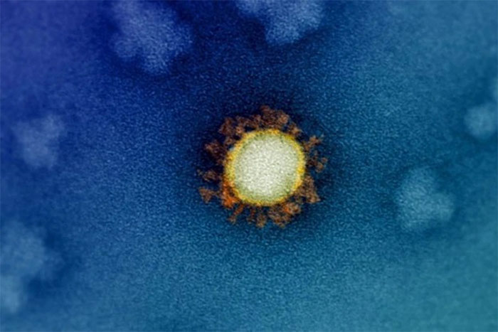 Science explains the 'extreme' evolutionary rate of the SARS-CoV-2 mutation Picture 1