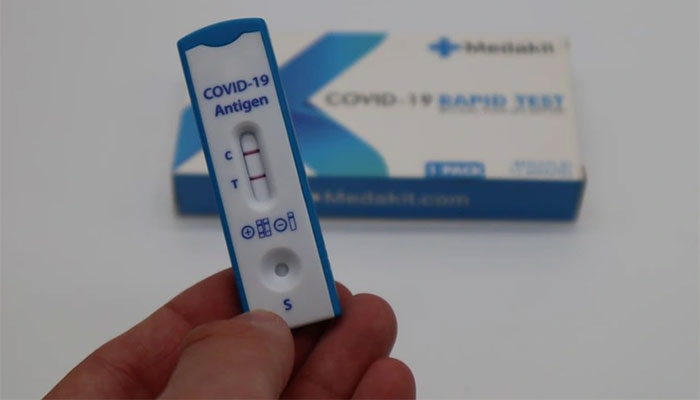 Science has given up on a man who has been positive for SARS-CoV-2 for 14 months Picture 2