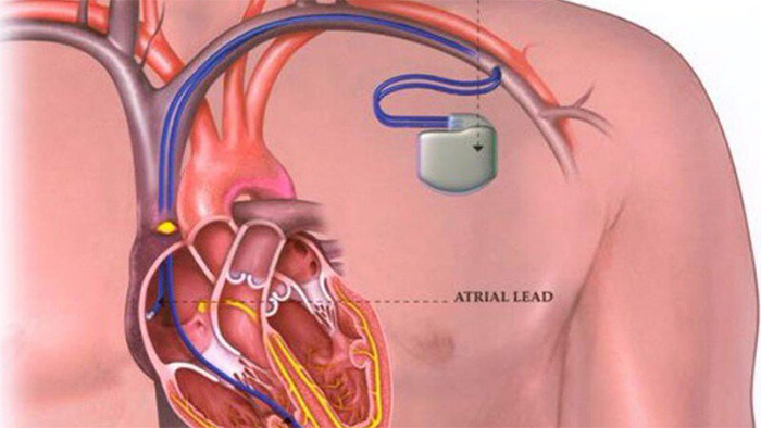 Scientists convert 'stress' into electricity, in the future anyone can discharge like Thor? Picture 3