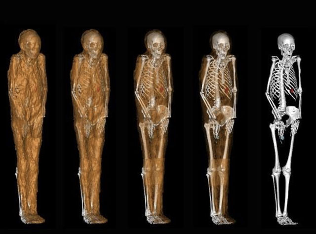 Picture 4 of Scientists use scanners to study Egyptian mummies and solve 3,000-year-old mystery!